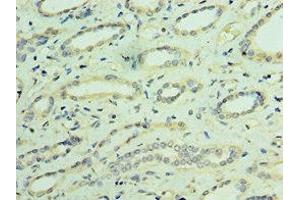 Immunohistochemistry of paraffin-embedded human kidney tissue using ABIN7172887 at dilution of 1:100 (TRPV4 Antikörper  (AA 1-230))