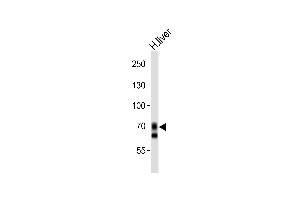 Western blot analysis of lysate from human liver tissue lysate, using SLCO1B1 Antibody (Center) (ABIN653562 and ABIN2842941).
