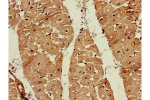 Immunohistochemistry of paraffin-embedded human heart tissue using ABIN7152571 at dilution of 1:100 (FDPS Antikörper  (AA 1-419))