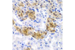 Immunohistochemistry of paraffin-embedded mouse kidney using HPD antibody at dilution of 1:100 (x40 lens). (HPD Antikörper)