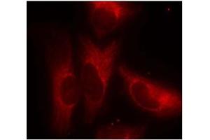 Image no. 3 for anti-14-3-3 zeta (YWHAZ) (pSer58) antibody (ABIN196916) (14-3-3 zeta Antikörper  (pSer58))