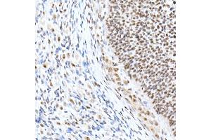 Immunohistochemistry of paraffin-embedded rat ovary using Nucleolin Rabbit mAb (ABIN7269035) at dilution of 1:25 (40x lens). (Nucleolin Antikörper)