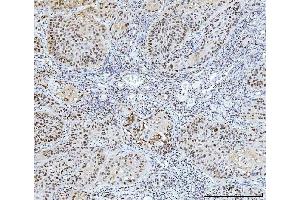 IHC analysis of FEN1 using anti-FEN1 antibody (ABIN7601619). (FEN1 Antikörper  (AA 4-300))