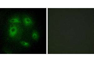 Peptide - +Immunohistochemistry analysis of paraffin-embedded human prostate carcinoma tissue, using DLEC1 antibody. (DLEC1 Antikörper)