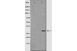 Western blot analysis of XBP1 expression in HepG2 cell lysate,The lane on the left is treated with the antigen-specific peptide. (XBP1 Antikörper  (C-Term))