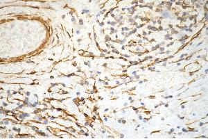 anti-Actin, alpha 2, Smooth Muscle, Aorta (ACTA2) antibody