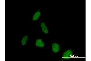 Immunofluorescence of purified MaxPab antibody to PSD on HeLa cell. (PSD Antikörper  (AA 1-1024))