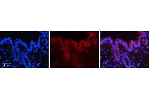 CALR antibody - C-terminal region (ARP30114_P050) Catalog Number: ARP30114_P050  Formalin Fixed Paraffin Embedded Tissue: Human Bronchial Epithelial Tissue  Observed Staining: Cytoplasm and membrane of bronchial epithelial tissue Primary Antibody Concentration: 1:100 Secondary Antibody: Donkey anti-Rabbit-Cy3  Secondary Antibody Concentration: 1:200  Magnification: 20X  Exposure Time: 0. (Calreticulin Antikörper  (C-Term))