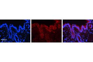 CALR antibody - C-terminal region (ARP30114_P050) Catalog Number: ARP30114_P050  Formalin Fixed Paraffin Embedded Tissue: Human Bronchial Epithelial Tissue  Observed Staining: Cytoplasm and membrane of bronchial epithelial tissue Primary Antibody Concentration: 1:100 Secondary Antibody: Donkey anti-Rabbit-Cy3  Secondary Antibody Concentration: 1:200  Magnification: 20X  Exposure Time: 0. (Calreticulin Antikörper  (C-Term))