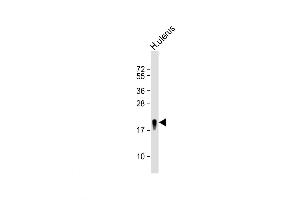 Western Blot at 1:8000 dilution + H. (Transgelin Antikörper  (N-Term))