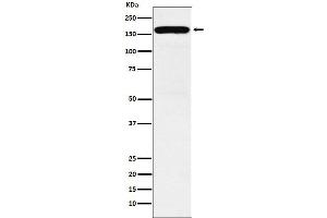 Western blot analysis of DIAPH1 expression in K562 cell lysate. (Rekombinanter DIAPH1 Antikörper)