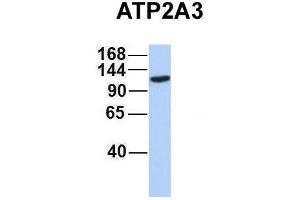 Host:  Rabbit  Target Name:  ATP2A3  Sample Type:  MCF7  Antibody Dilution:  1. (ATP2A3 Antikörper  (Middle Region))