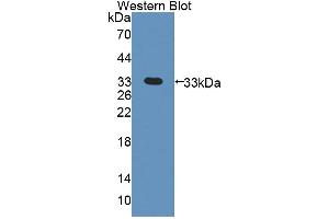 Western blot analysis of the recombinant protein. (PDK3 Antikörper  (AA 138-396))
