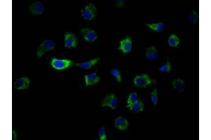Immunofluorescence staining of MCF7 Cells with ABIN7127572 at 1:50, counter-stained with DAPI. (Rekombinanter ILK Antikörper)
