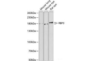 Western blot analysis of extracts of various cell lines using RBP3 Polyclonal Antibody at dilution of 1:1000. (RBP3 Antikörper)