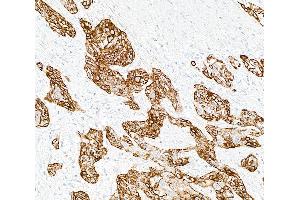 Immunohistochemistry (IHC) image for anti-Keratin 14 (KRT14) (C-Term) antibody (ABIN7795698)