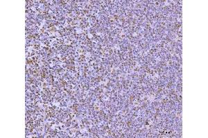 IHC analysis of GLIS1 using anti-GLIS1 antibody (ABIN7599501). (GLIS1 Antikörper  (AA 1-620))