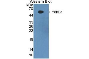 Detection of Recombinant FGb, Human using Polyclonal Antibody to Fibrinogen Beta Chain (FGB)