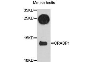 Western blot analysis of extracts of mouse testis, using CRABP1 antibody (ABIN6291540) at 1:3000 dilution. (CRABP1 Antikörper)