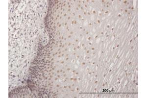 Immunohistochemistry (Formalin-fixed Paraffin-embedded Sections) (IHC (fp)) image for anti-Core-binding Factor, Runt Domain, alpha Subunit 2, Translocated To, 3 (CBFA2T3) (AA 1-615) antibody (ABIN514063)