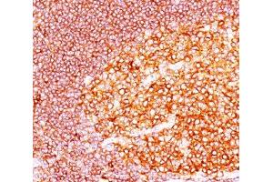 IHC staining of tonsil tissue with MALT1 antibody (MT1/410). (MALT1 Antikörper  (AA 701-808))
