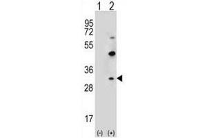 Western blot analysis of CLDN2 (arrow) using rabbit polyclonal CLDN2 Antibody (pTyr195) . (Claudin 2 Antikörper  (C-Term))