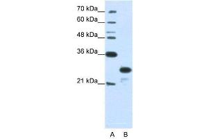 WB Suggested Anti-ANP32A  Antibody Titration: 1. (PHAP1 Antikörper  (N-Term))