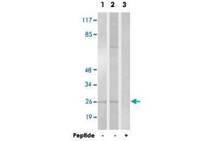 Western blot analysis of extracts from HT-29 cells (Lane 1) and K-562 cells (Lane 2 and lane 3), using HOXA6 polyclonal antibody . (HOXA6 Antikörper)
