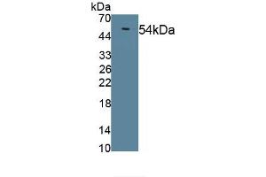 Detection of Recombinant LIPD, Mouse using Polyclonal Antibody to Lipoprotein lipase (LPL) (Lipoprotein Lipase Antikörper)