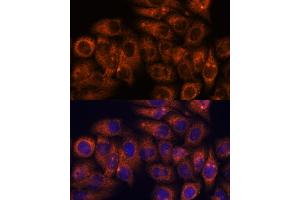 Immunofluorescence analysis of HeLa cells using STE antibody (ABIN7270588) at dilution of 1:100. (STEAP4 Antikörper  (AA 1-100))