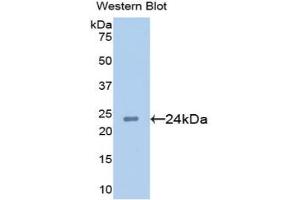 Western blot analysis of the recombinant protein. (AGR2 Antikörper  (AA 21-175))