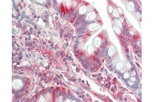 anti-Trk-Fused Gene (TFG) antibody