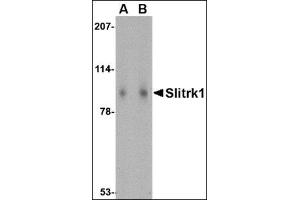 Western blot analysis of Slitrk1 in human brain tissue lysate with this product at (A) 1 and (B) 2 μg/ml. (SLITRK1 Antikörper  (Middle Region))