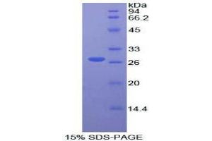 SDS-PAGE (SDS) image for Fibroblast Growth Factor Receptor Substrate 2 (FRS2) (AA 239-449) protein (His tag) (ABIN1877487) (FRS2 Protein (AA 239-449) (His tag))