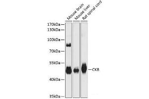 Western blot analysis of extracts of various cell lines using CKB Polyclonal Antibody at dilution of 1:3000. (CKB Antikörper)