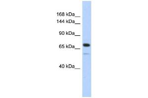 WB Suggested Anti-CALD1 Antibody Titration:  0. (Caldesmon Antikörper  (Middle Region))