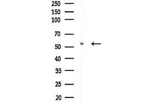 anti-Thioredoxin Reductase 2 (TXNRD2) (C-Term) antibody