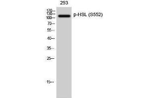 Western Blotting (WB) image for anti-Lipase, Hormone-Sensitive (LIPE) (pSer552) antibody (ABIN3182522) (LIPE Antikörper  (pSer552))