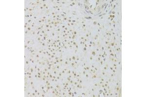 Immunohistochemistry (Paraffin-embedded Sections) (IHC (p)) image for anti-PRP3 Pre-mRNA Processing Factor 3 Homolog (PRPF3) (AA 1-280) antibody (ABIN6146260)
