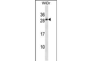 Western blot analysis in WiDr cell line lysates (35ug/lane).