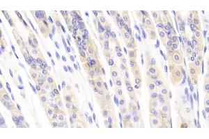 Detection of CCL1 in Mouse Stomach Tissue using Polyclonal Antibody to Chemokine C-C-Motif Ligand 1 (CCL1) (CCL1 Antikörper  (AA 24-92))