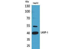 Western Blotting (WB) image for anti-LIM and SH3 Protein 1 (LASP1) (Internal Region) antibody (ABIN3178265) (LASP1 Antikörper  (Internal Region))