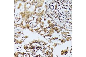 Immunohistochemistry (IHC) image for anti-Death-Associated Protein Kinase 3 (DAPK3) (AA 1-100) antibody (ABIN7266712)