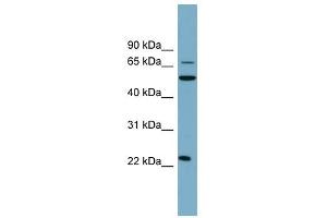 CLEC6A antibody used at 1 ug/ml to detect target protein. (C-Type Lectin Domain Family 6, Member A (CLEC6A) (N-Term) Antikörper)