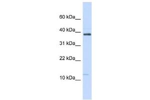 SPINK1 antibody used at 1 ug/ml to detect target protein. (SPINK1 Antikörper  (N-Term))