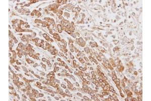 IHC-P Image Immunohistochemical analysis of paraffin-embedded MDA-MB468 xenograft, using NYD-SP26, antibody at 1:100 dilution.
