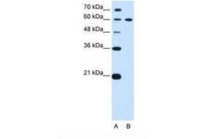 Image no. 1 for anti-Deltex Homolog 2 (DTX2) (AA 454-503) antibody (ABIN6739165) (DTX2 Antikörper  (AA 454-503))