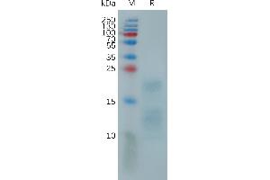 MPXV A29L (AA 1-110) protein (His tag)