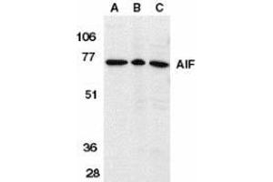 Western blot analysis of AIF in K562 cell lysate (A), rat heart (B), and mouse heart (C) tissue lysates with AP30030PU-N AIF antibody (IN) at 1 μg/ml. (AIF Antikörper  (Intermediate Domain))