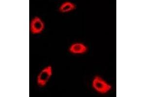 Immunofluorescent analysis of AK4 staining in A549 cells.